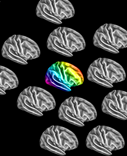 Autistic brains go their own way