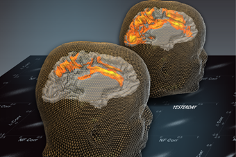 Israeli Research Shows that Scans Reveal Past Brain Activity