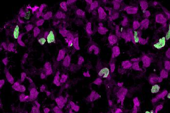 Of Mice and Men: Researchers Find Differences in Cell Development