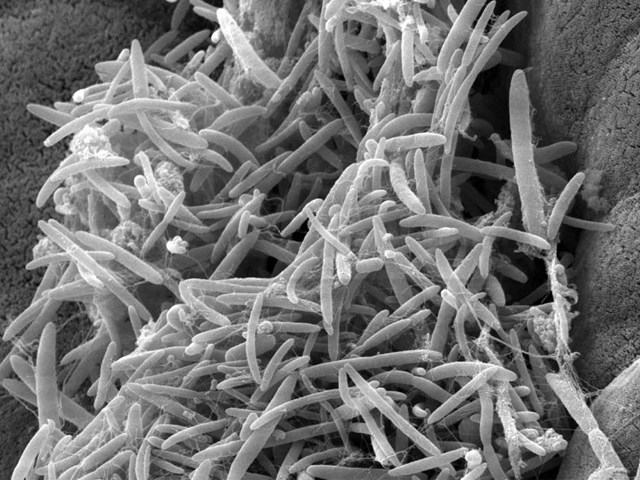 gut microbes