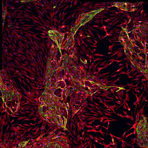 Fixing A Broken Heart