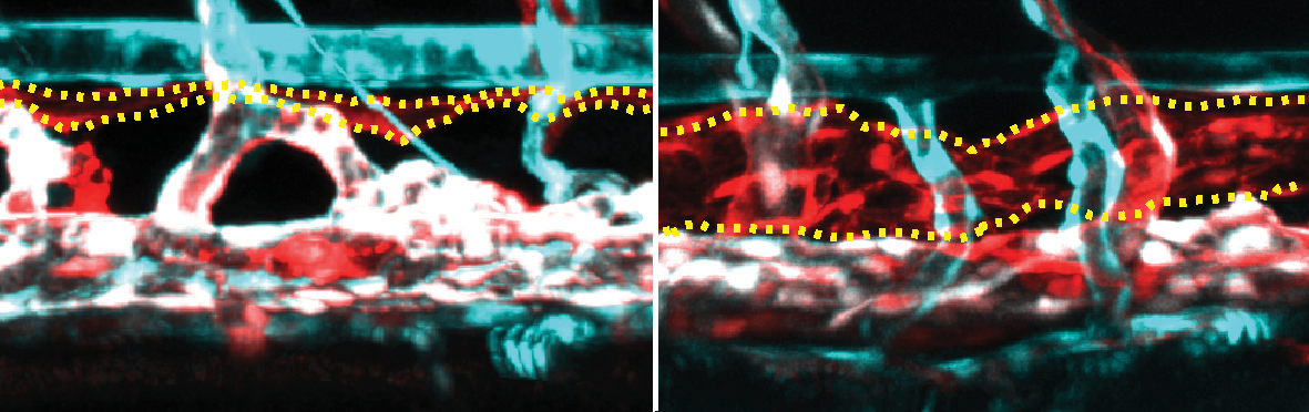 Fishing For A Drug Study Brings Hope For Treating A Rare Disease 4