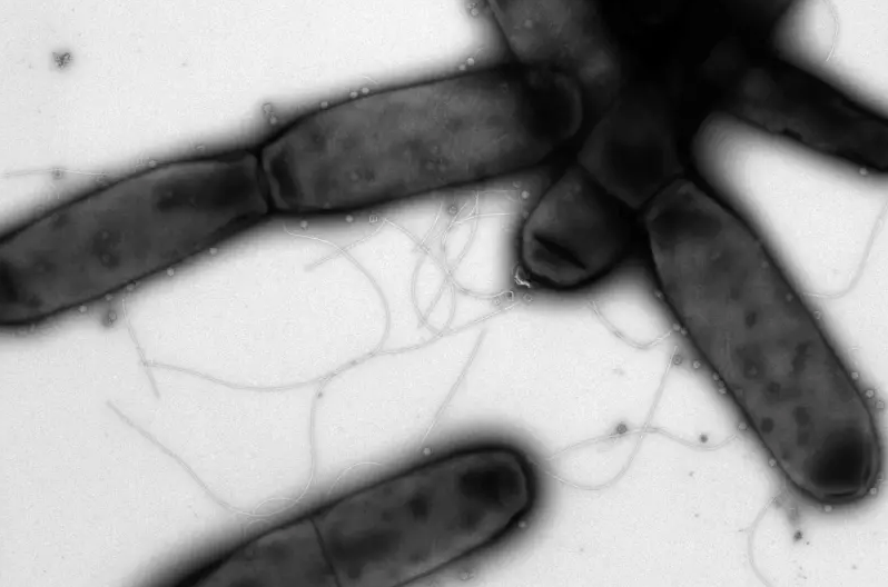 Enzymes in Bacteria Could Help Fight Coronavirus – Weizmann Institute