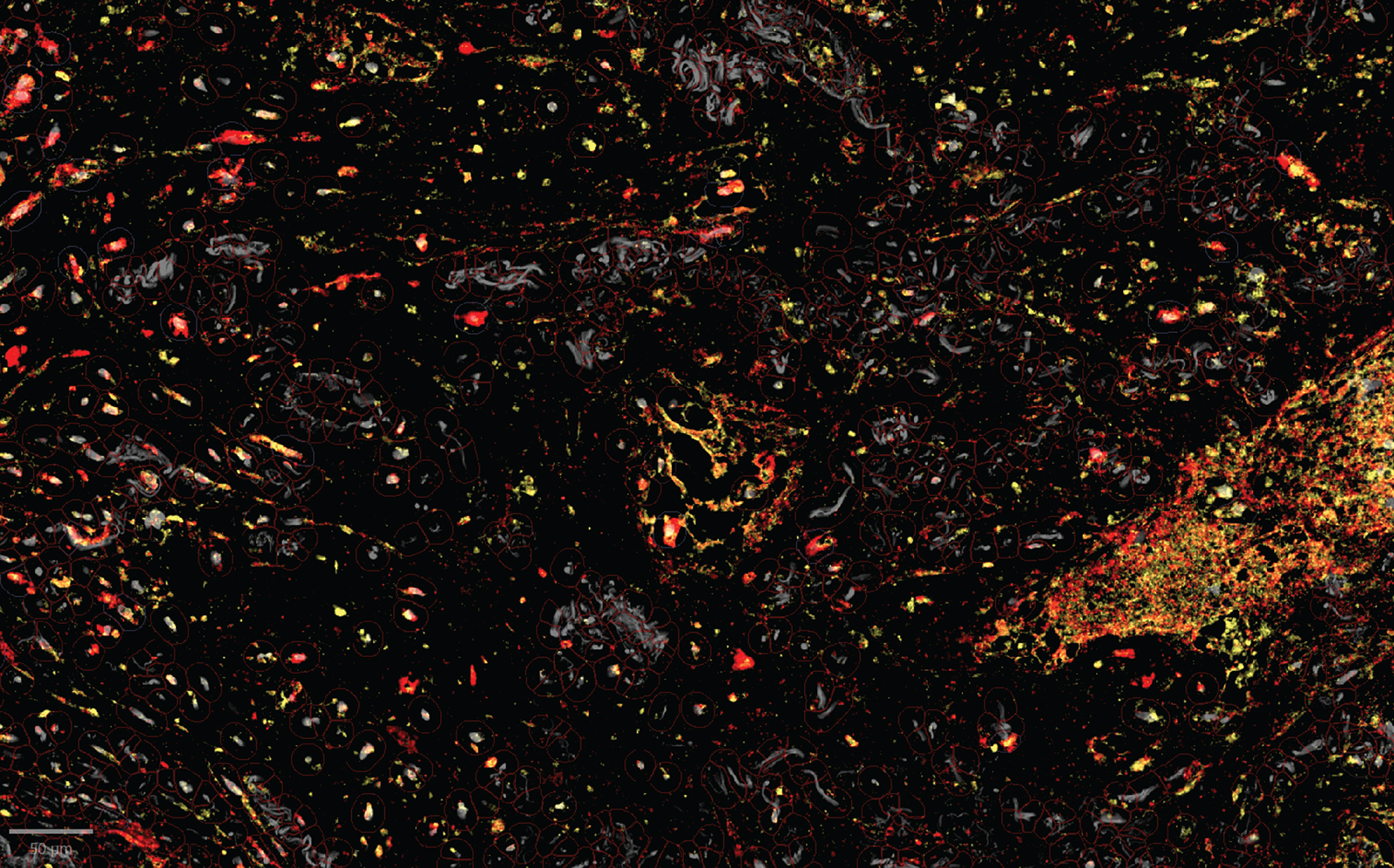 Turning The Tumors Shield Into A Sword 2