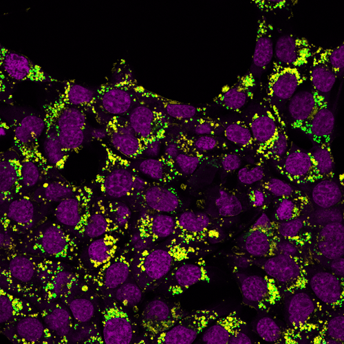 Viagra May Reduce Cancer Metastasis Study Shows 2