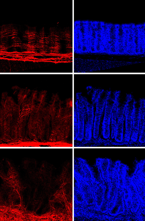 When The Gut Can’T Forget A New Mechanism Promoting Inflammatory Bowel Disease 3