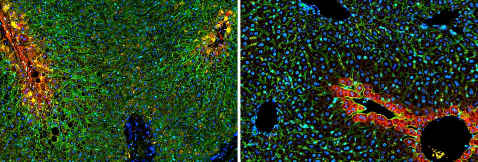 A Journey To The Center Of The Liver 2